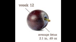 12 Weeks Pregnant Baby Heartbeat