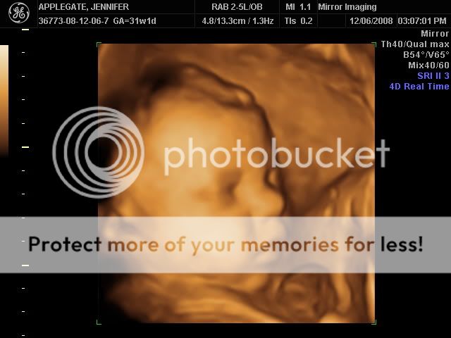 12 Weeks Pregnant Pictures 3d Ultrasound