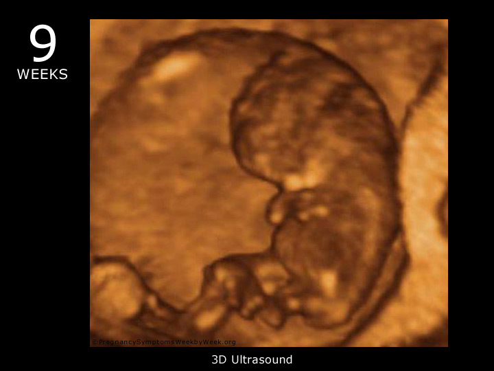 12 Weeks Pregnant Pictures 3d Ultrasound