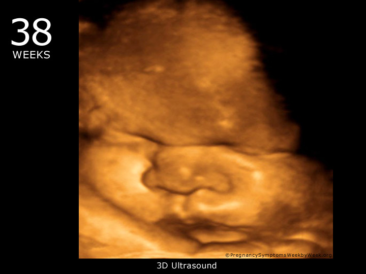 12 Weeks Pregnant Pictures 3d Ultrasound