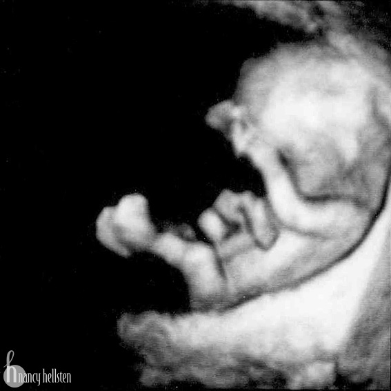 12 Weeks Pregnant Ultrasound