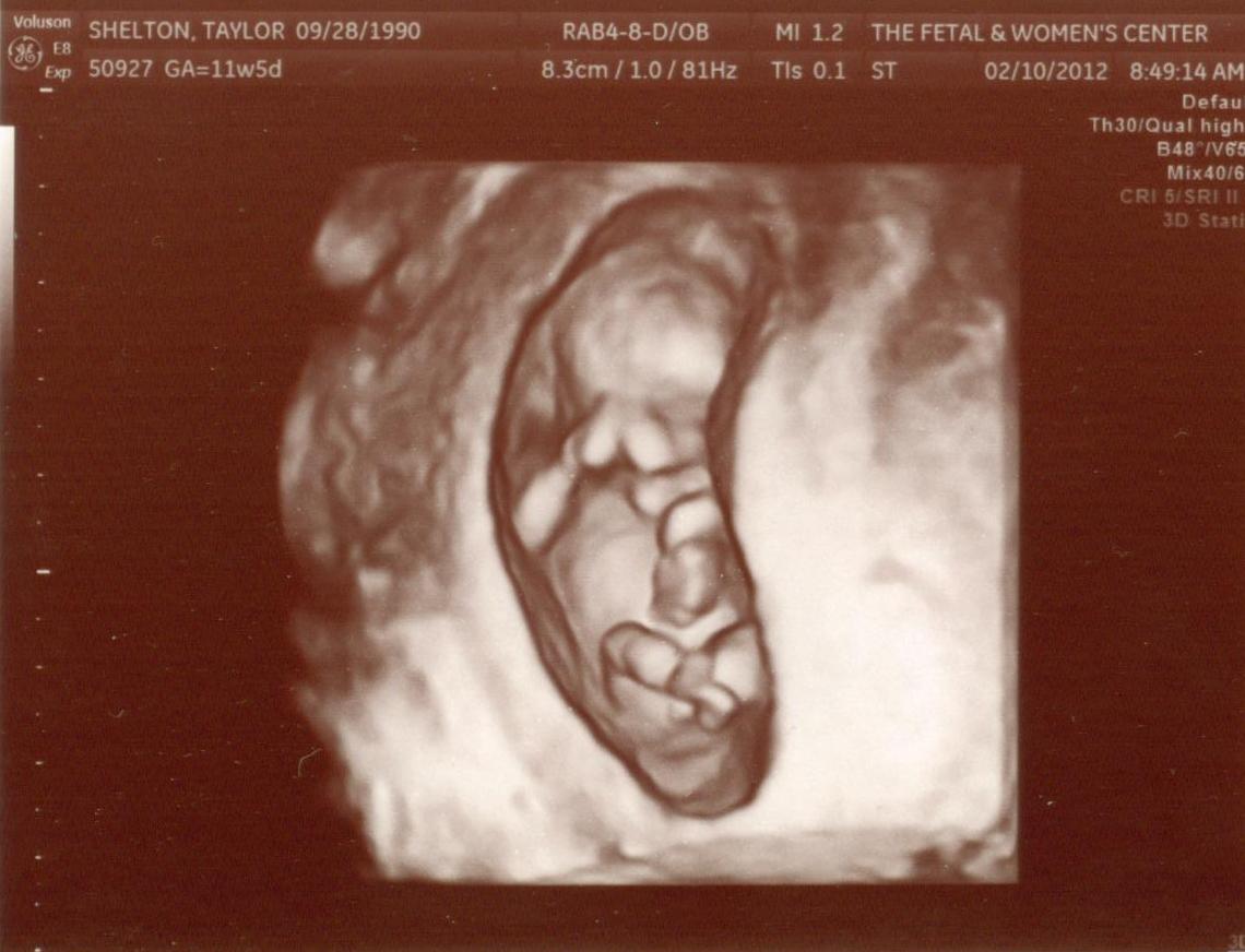 12 Weeks Pregnant Ultrasound Boy