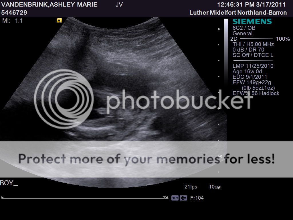 12 Weeks Pregnant Ultrasound Boy