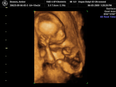 Gender 3d Ultrasound