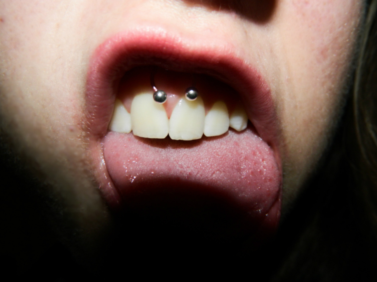 Smiley Piercing