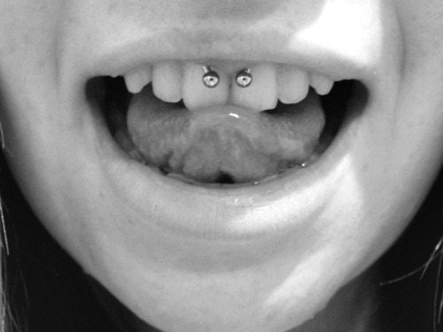 Smiley Piercing