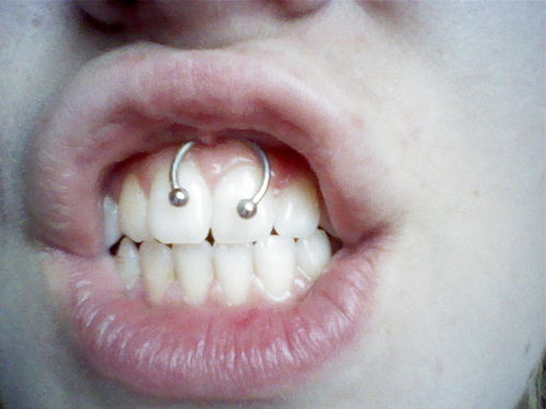 Smiley Piercing