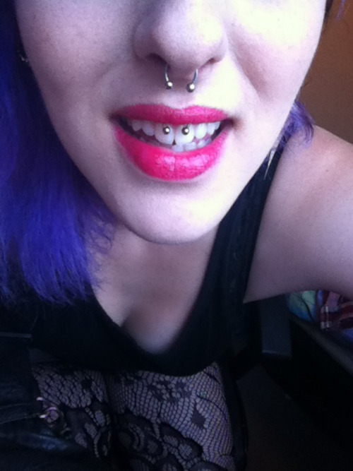 Smiley Piercing