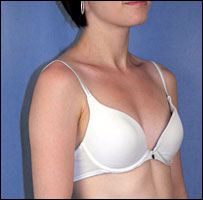 32aa Breast Size Photos