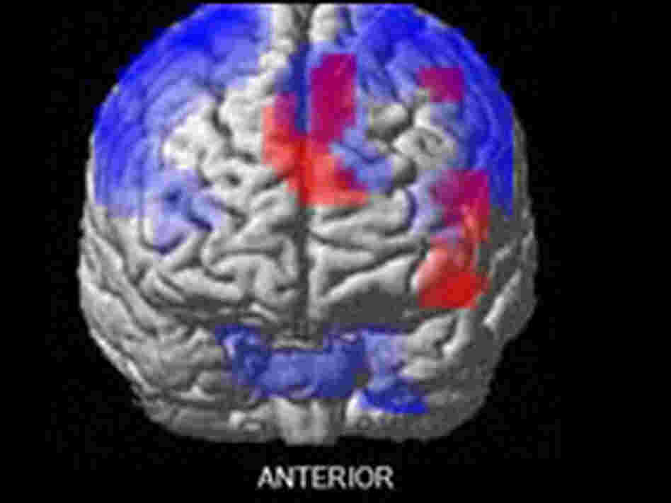 6 Regions Of The Brain