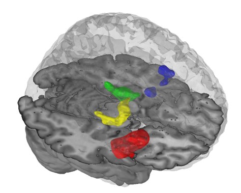 6 Regions Of The Brain