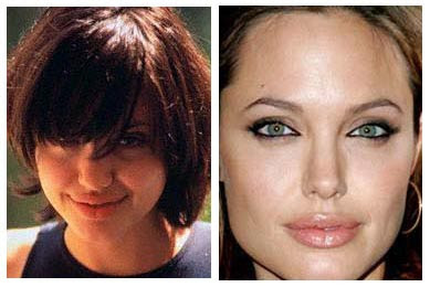 Angelina Jolie Lips Before