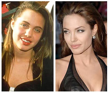 Angelina Jolie Lips Before Surgery