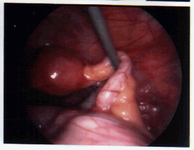 Appendix