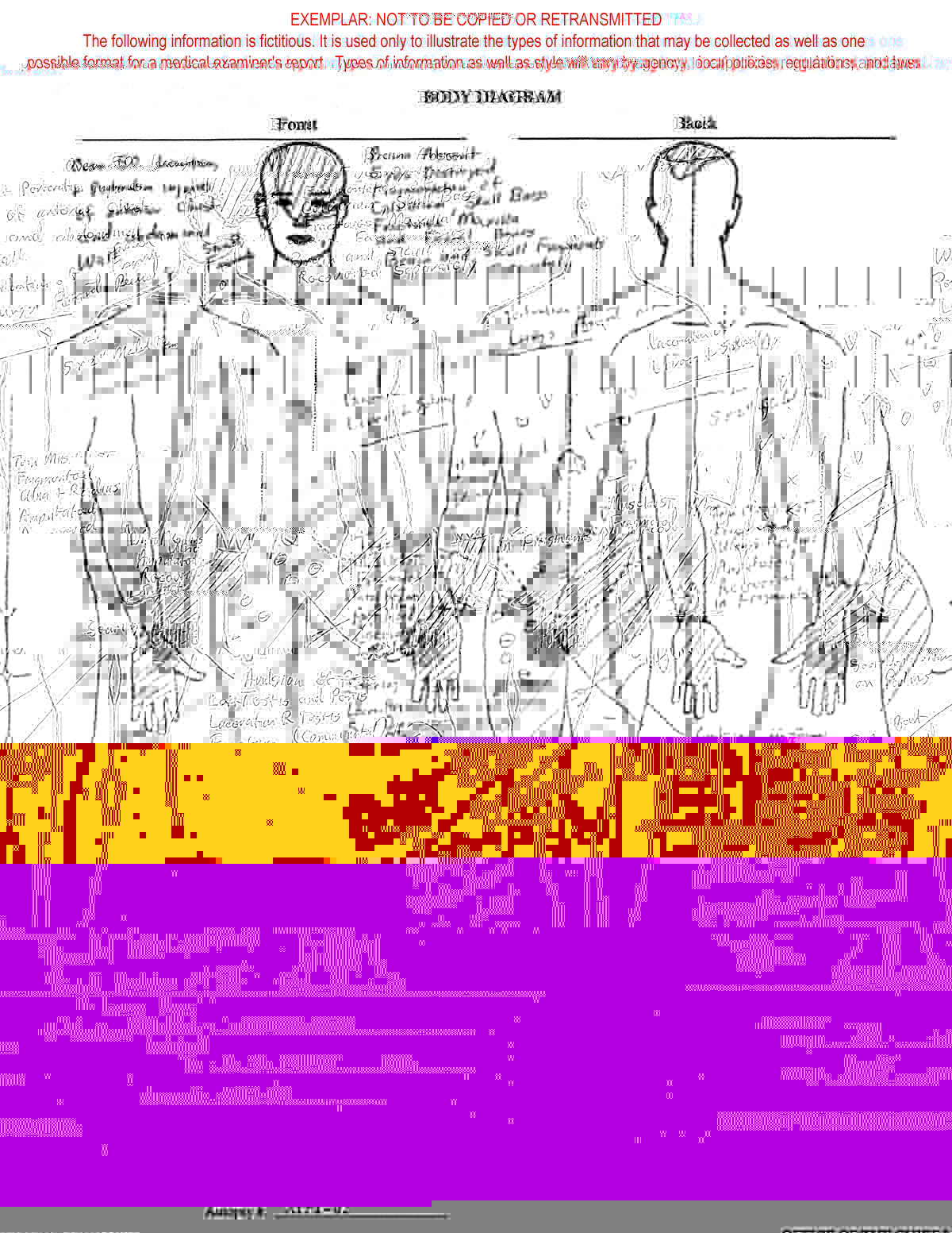 Appendix Diagram Human Body