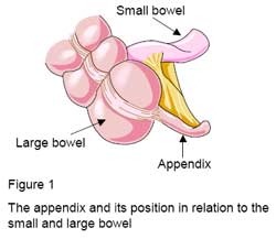 Appendix Location Pain