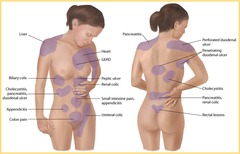 Appendix Location Pain