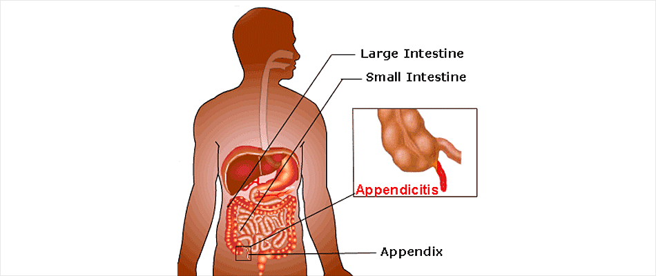 Appendix Operation Cost