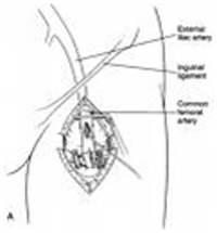 Appendix Operation Cost In Mumbai