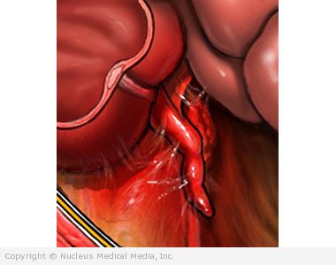 Appendix Operation Pictures