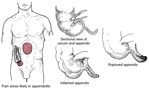 Appendix Operation Time