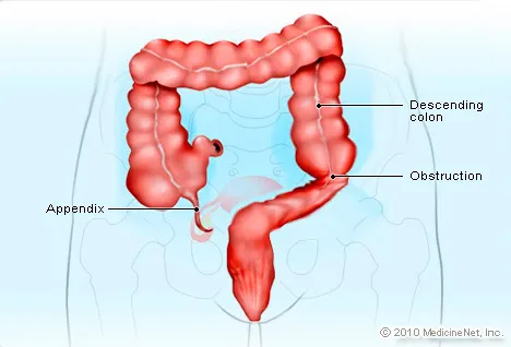 Appendix Operation Time