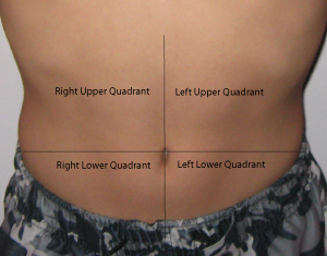 Appendix Pain Location In Children