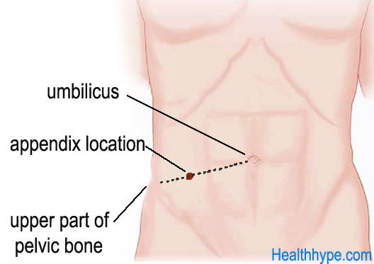 Appendix Pain Location Men