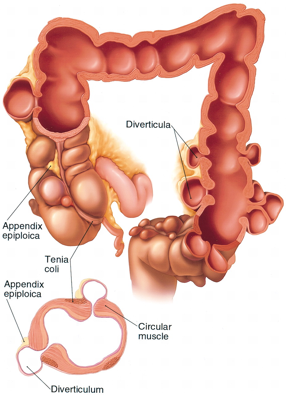 Appendix Pain Symptoms