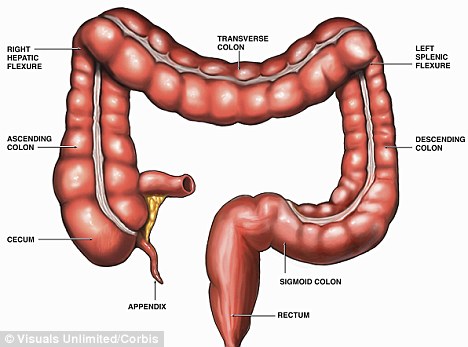 Appendix Scar Removal