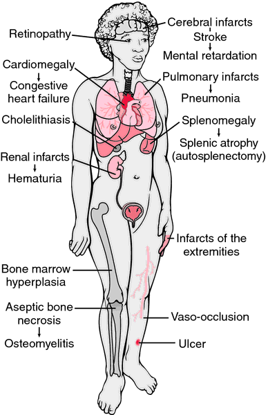 Autosomal Dominant Disorders Definition