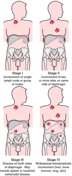 Autosomal Dominant Disorders Definition