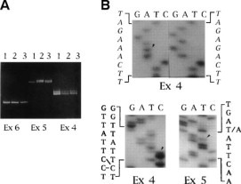 Autosomal Dominant Polycystic Kidney Disease Genetics