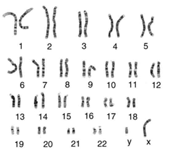 Autosomes In A Karyotype