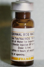 Bcg Vaccine Side Effects Children