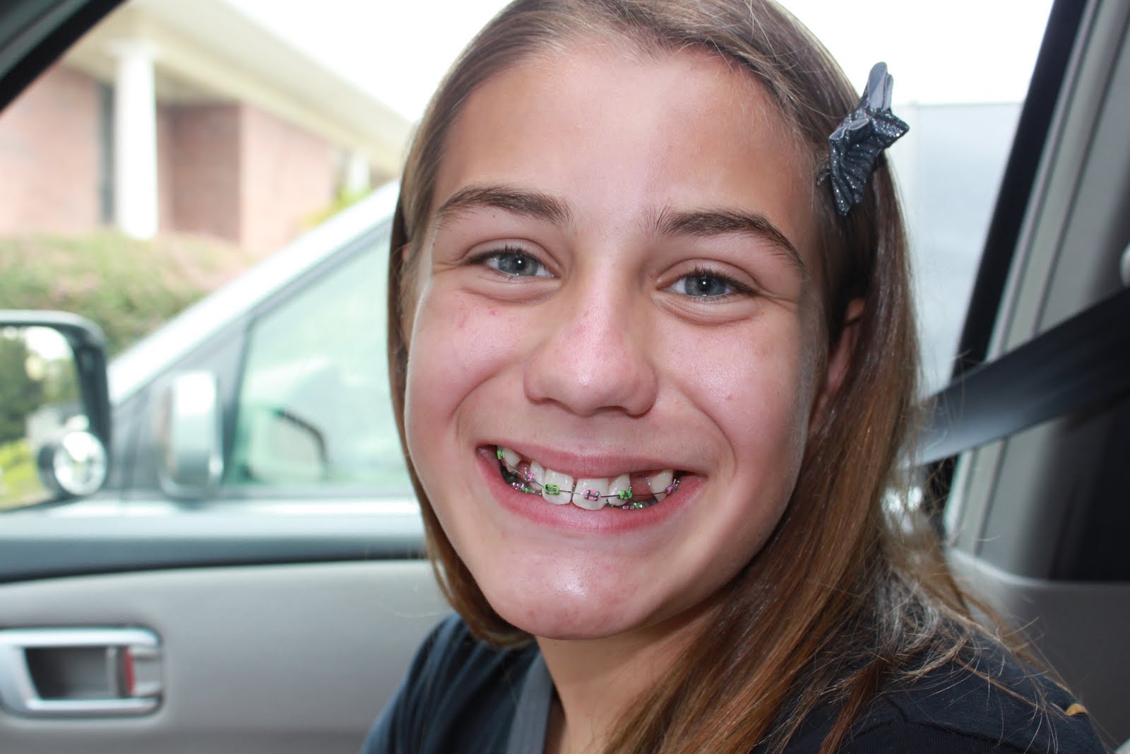 Braces Colors For Girls