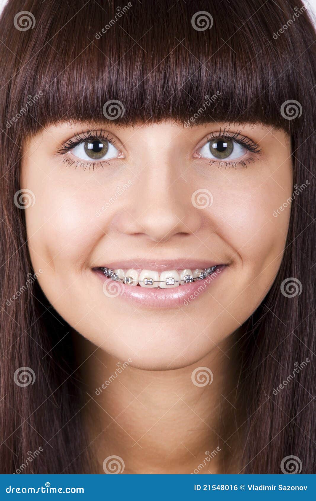 Braces Colors For Girls Teeth