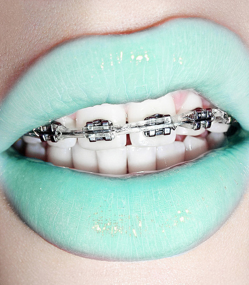 Braces Colors Tumblr