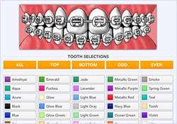 Braces For Teeth Colours