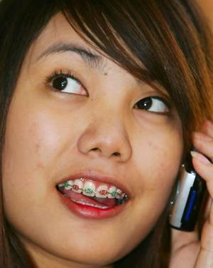 Braces For Teeth Design