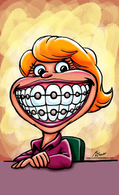 Braces Smile Cartoon