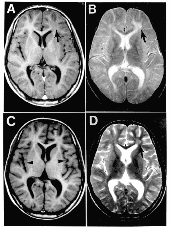 Brain Anatomy Mri Images