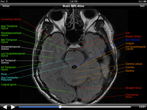 Brain Anatomy Mri Images