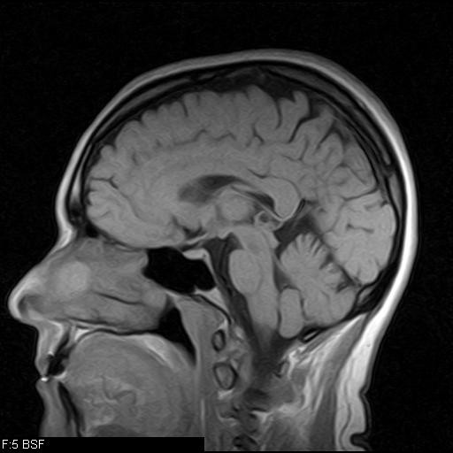 Brain Anatomy Mri Images