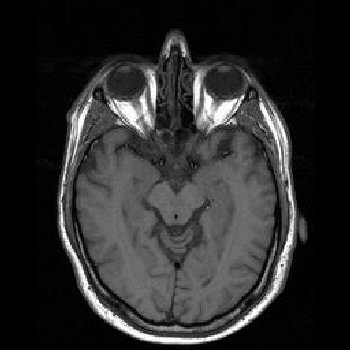 Brain Anatomy Mri Images