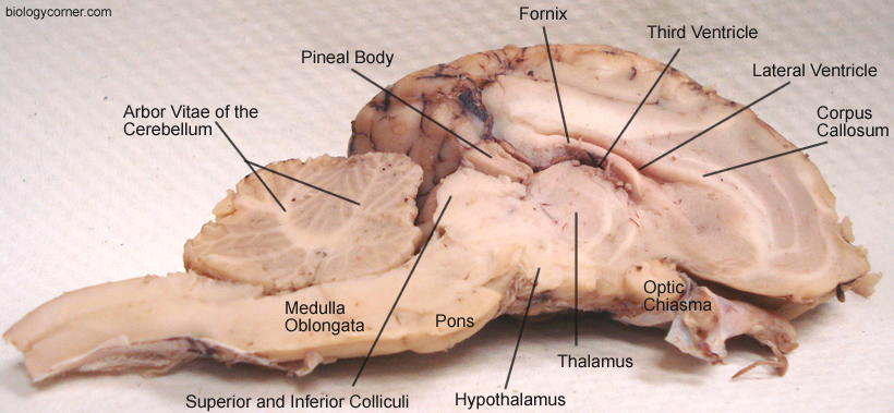 Brain Anatomy Quiz Labeling