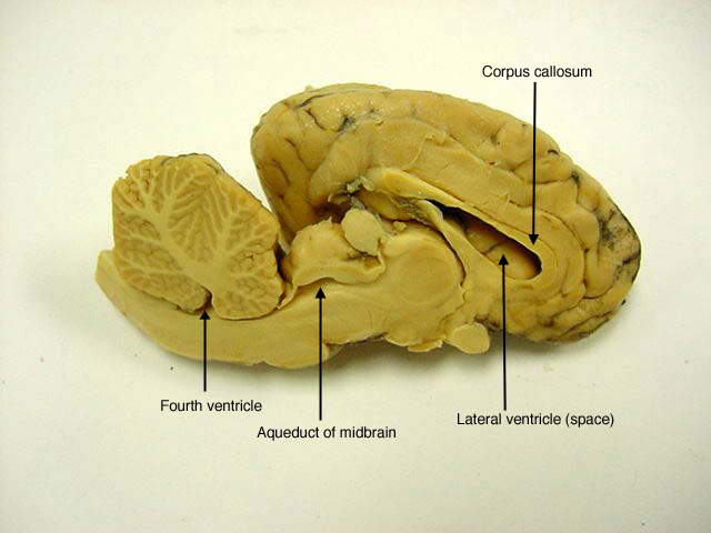 Brain Anatomy Quiz Labeling