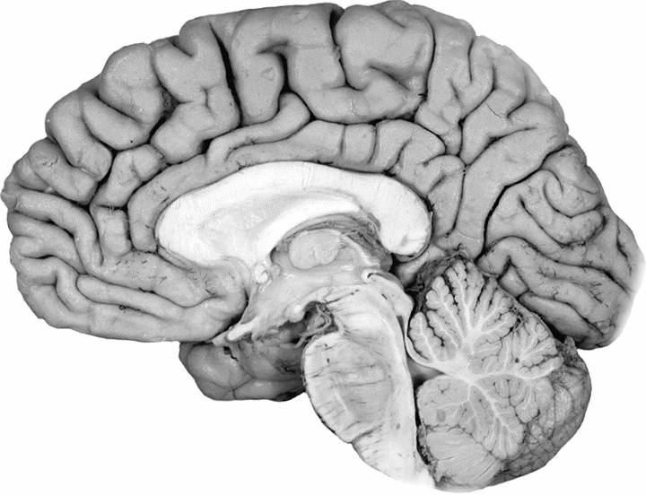 Brain Anatomy Quizzes