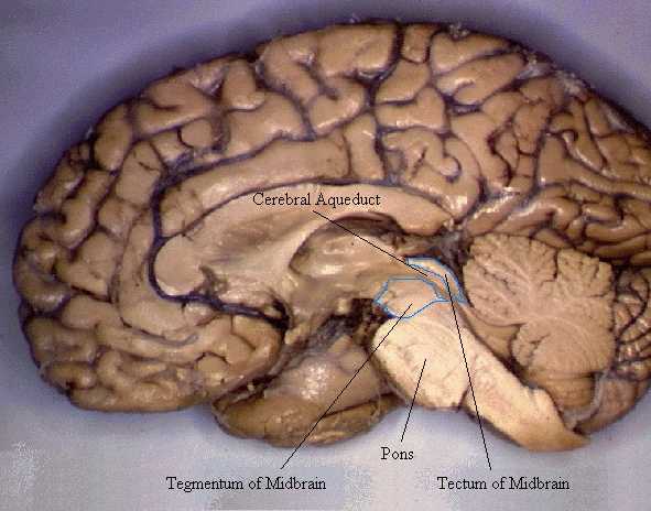 Brain Anatomy Quizzes