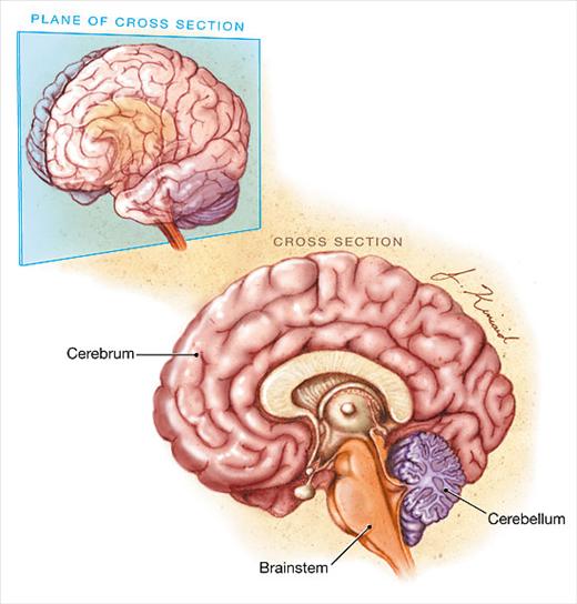 Brain Stem Death Criteria